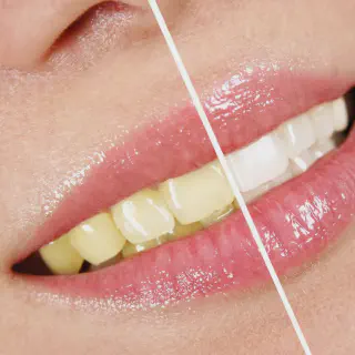 /img/25707-dental-checkup-marysville.webp