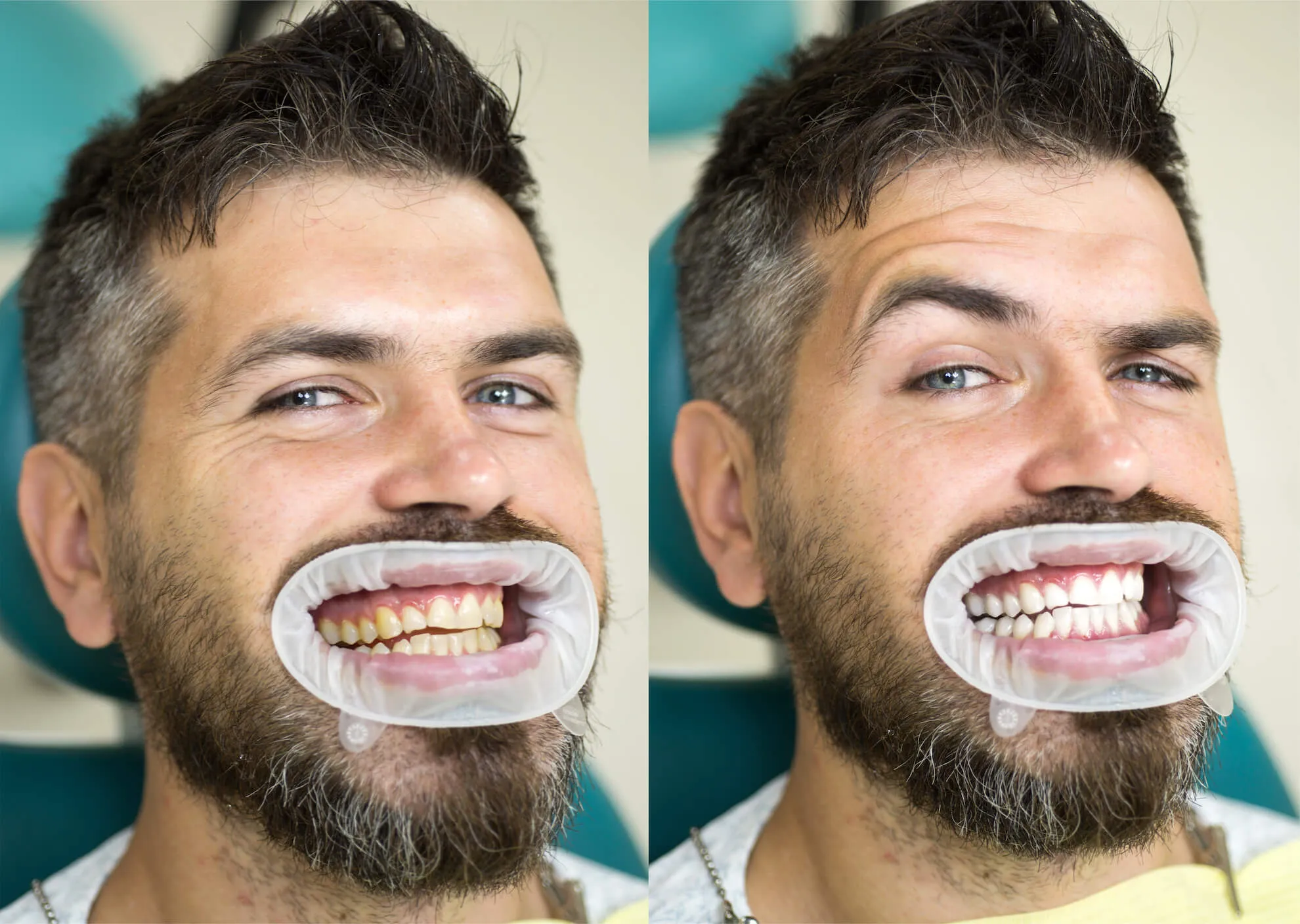 25707 oral hygiene marysville
