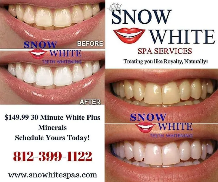 25707 professional whitening marysville