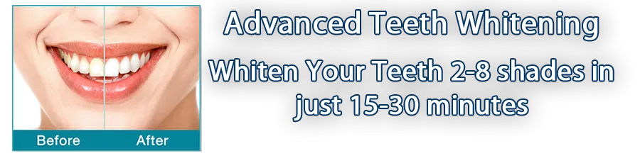 25707 teeth whitening marysville