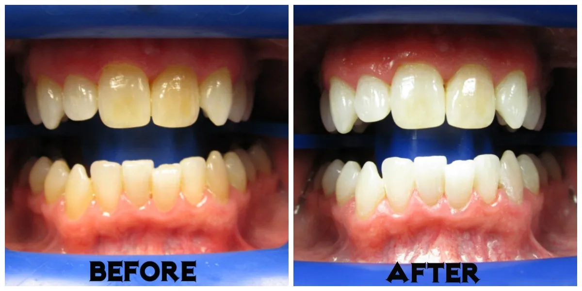25708 dental exam