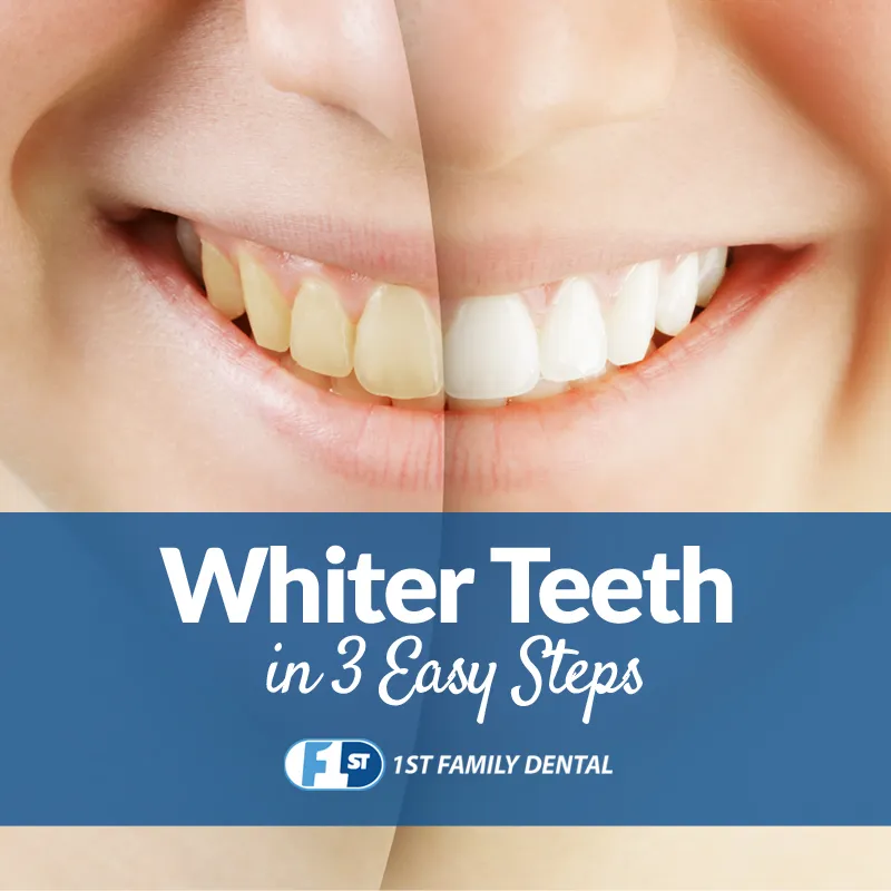 /img/25708-teeth-smile.webp