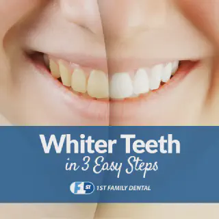 /img/25708-teeth-smile.webp