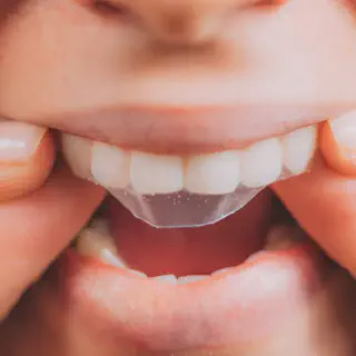 /img/25710-teeth-whitening-comparison.webp