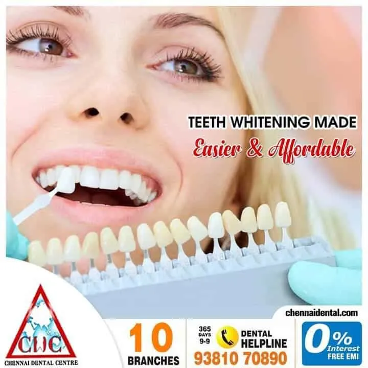 25712 teeth whitening chennai main