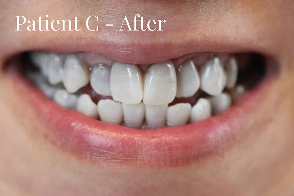 /img/25713-kor-whitening-professional.webp