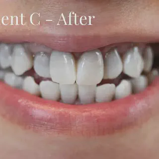 /img/25713-kor-whitening-professional.webp