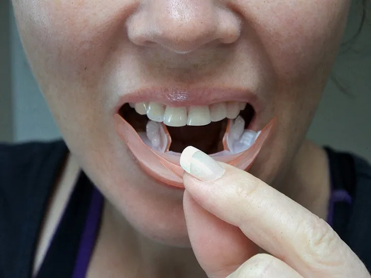 25720 enamel erosion