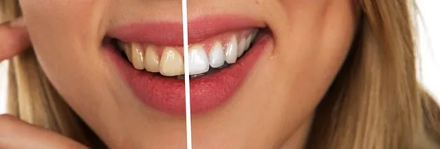 25722 dental work