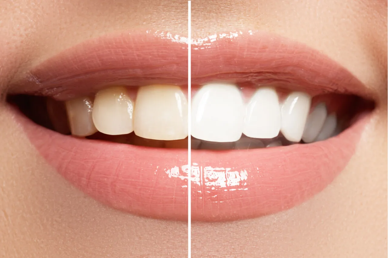 /img/25722-desensitizing-toothpaste.webp