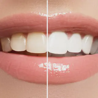 /img/25722-desensitizing-toothpaste.webp