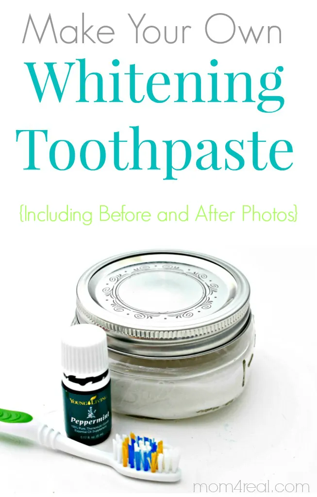 25724 hydrogen peroxide teeth