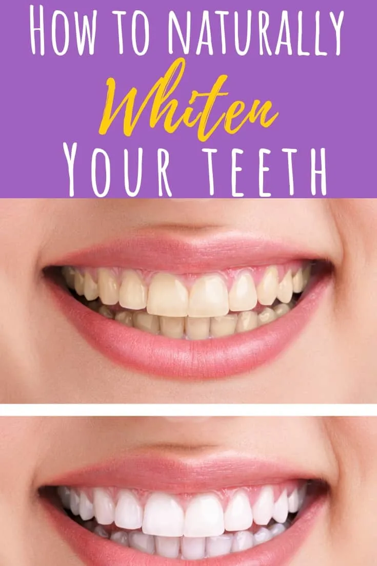 /img/25724-professional-teeth-whitening.webp