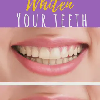/img/25724-professional-teeth-whitening.webp
