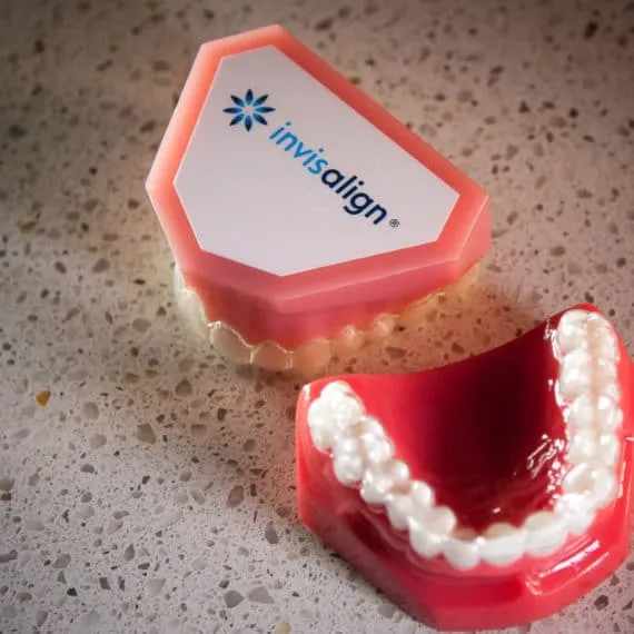 25725 invisalign buttons overview