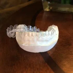/img/25732-teeth-whitening-chattanooga-tn-image7.webp