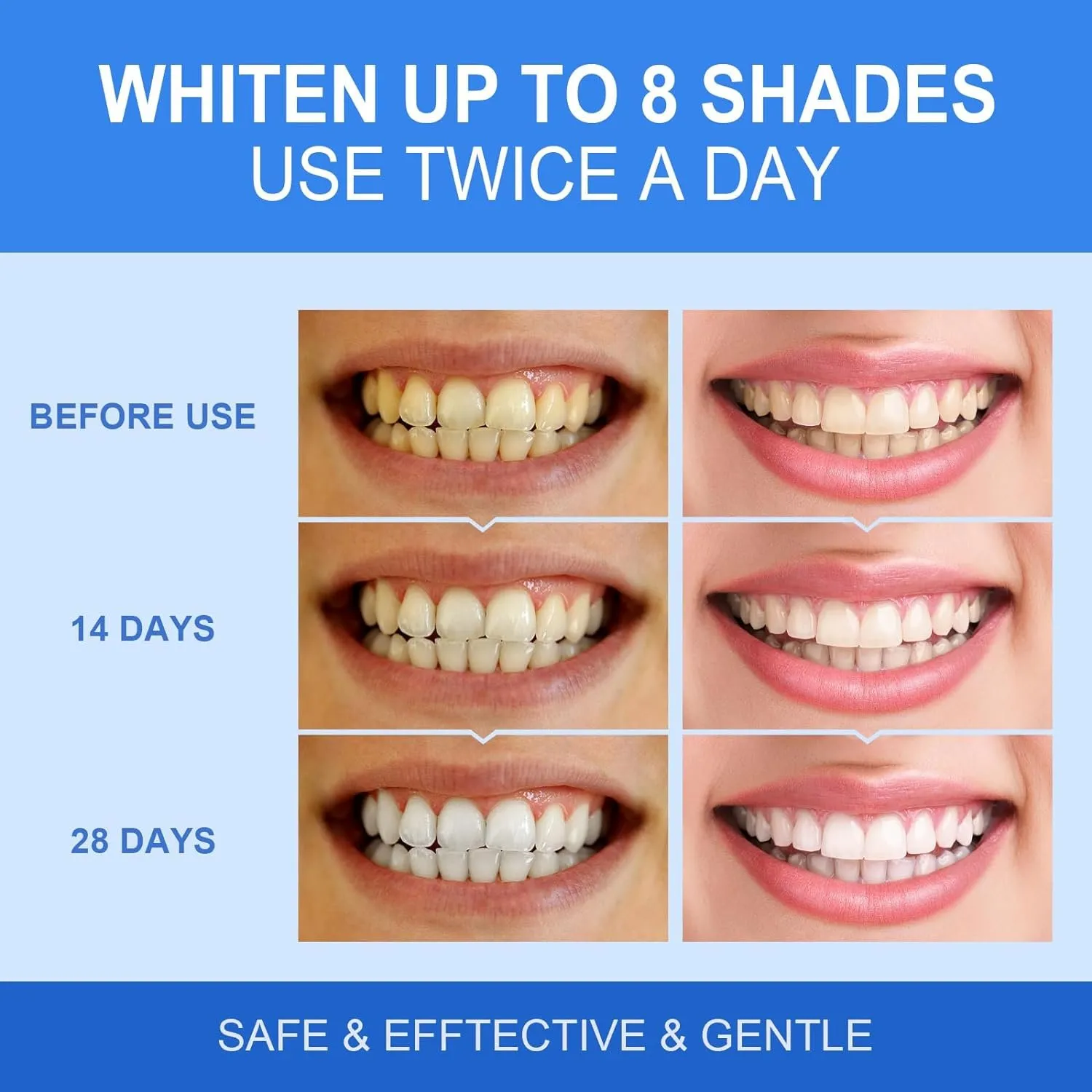 25735 applying whitening gel