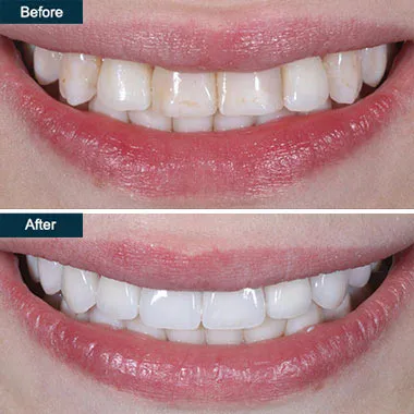 /img/25738-find-dentist.webp