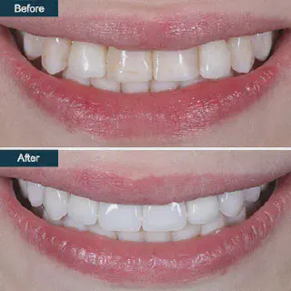 /img/25738-find-dentist.webp