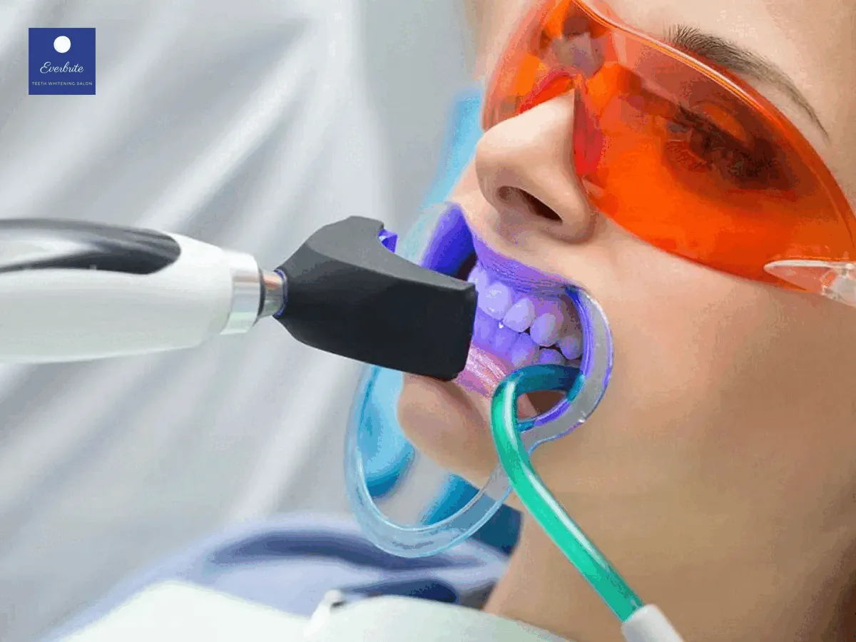 25740 teeth whitening aftercare