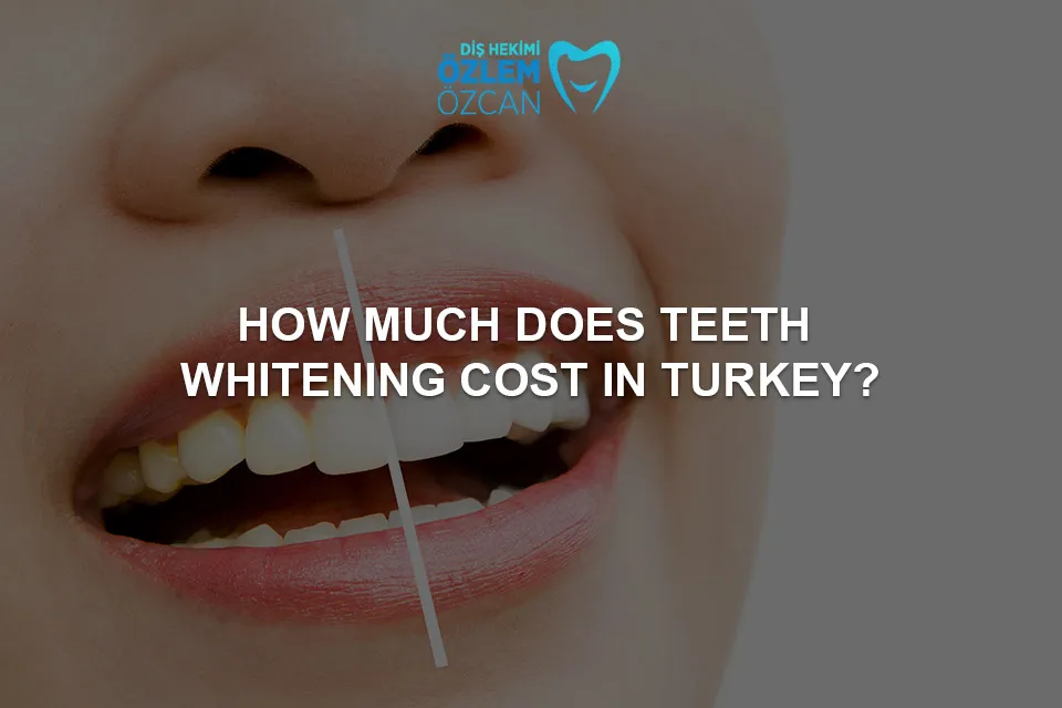 25741 affordable teeth whitening