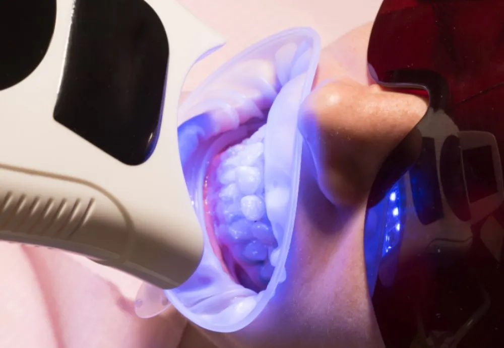 25741 at home teeth whitening kits
