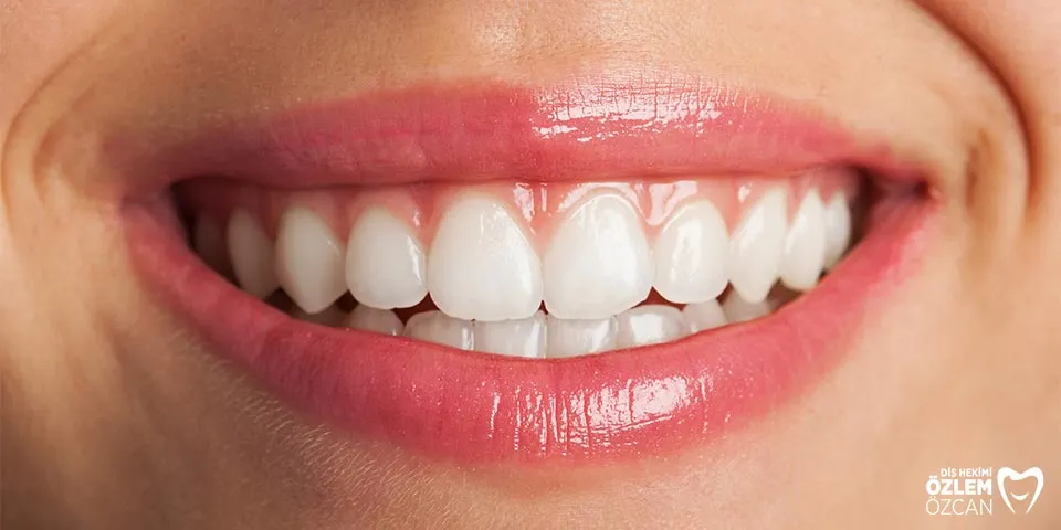 /img/25741-teeth-whitening-aftercare.webp