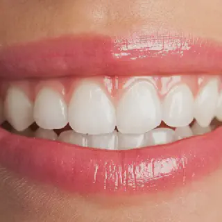 /img/25741-teeth-whitening-aftercare.webp