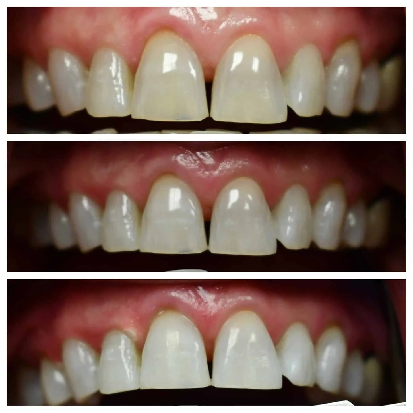 /img/25743-teeth-whitening-bradenton-fl-smile.webp