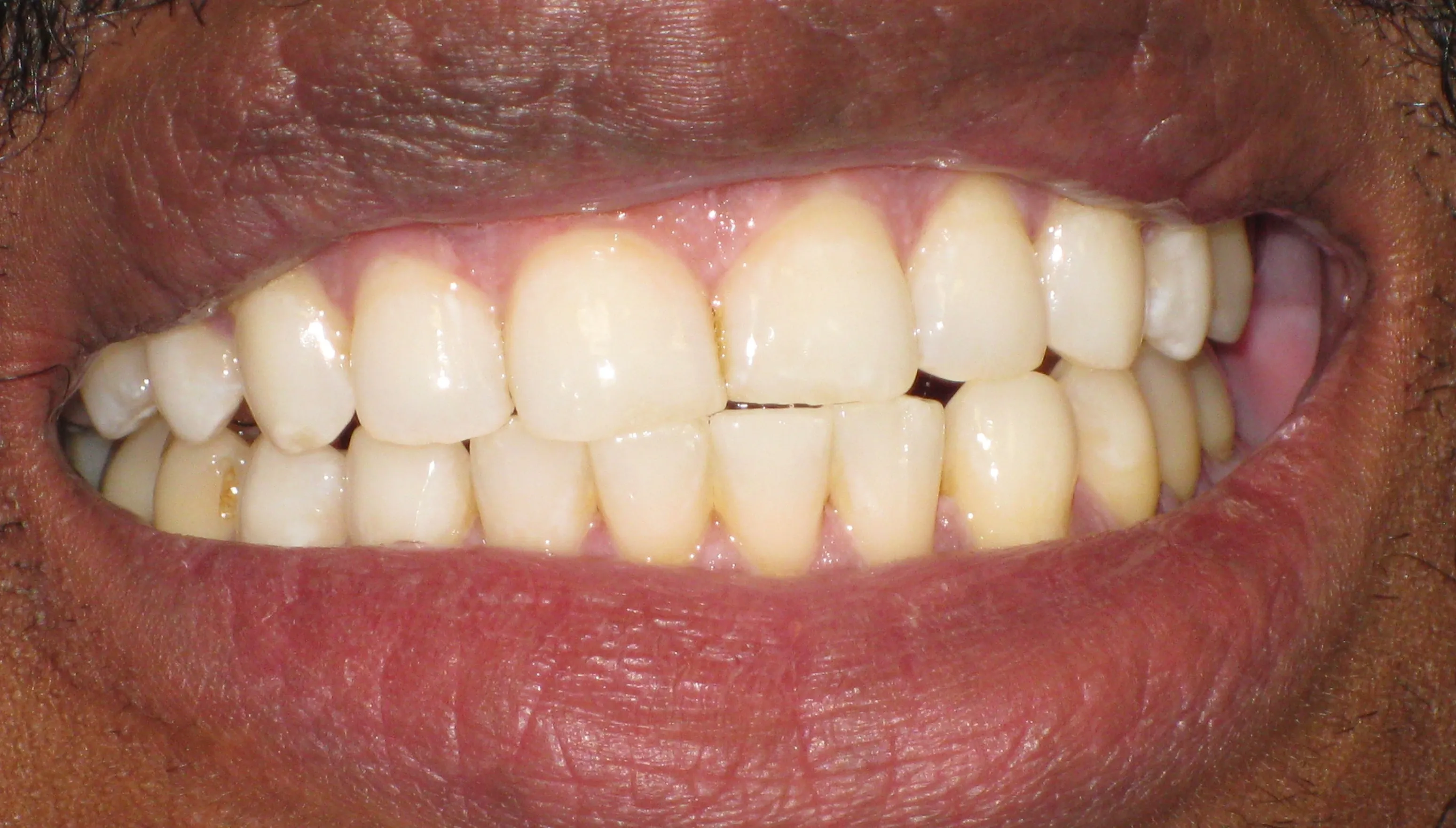 25745 professional treatment
