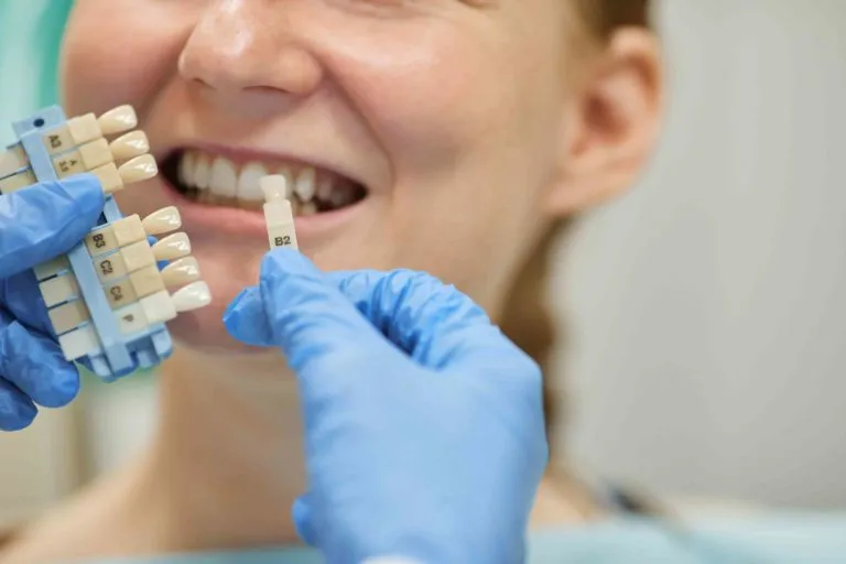 25749 at home teeth whitening kits