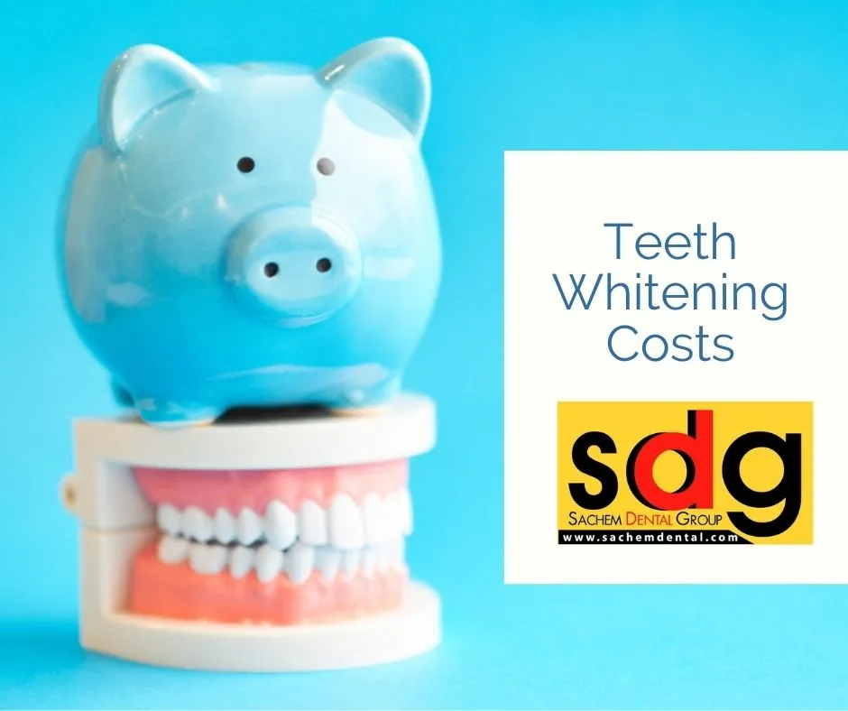 /img/25749-smiling-white-teeth.webp