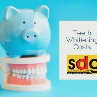 /img/25749-smiling-white-teeth.webp
