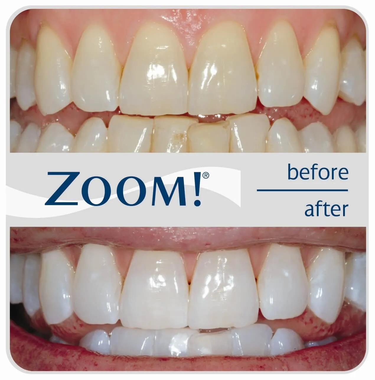 25749 teeth discoloration chart