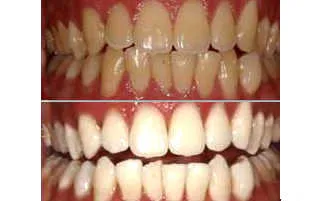 25755 dentist consultation gurgaon