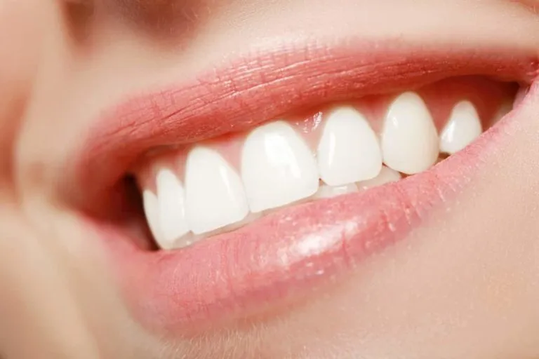 25757 teeth whitening florida image1