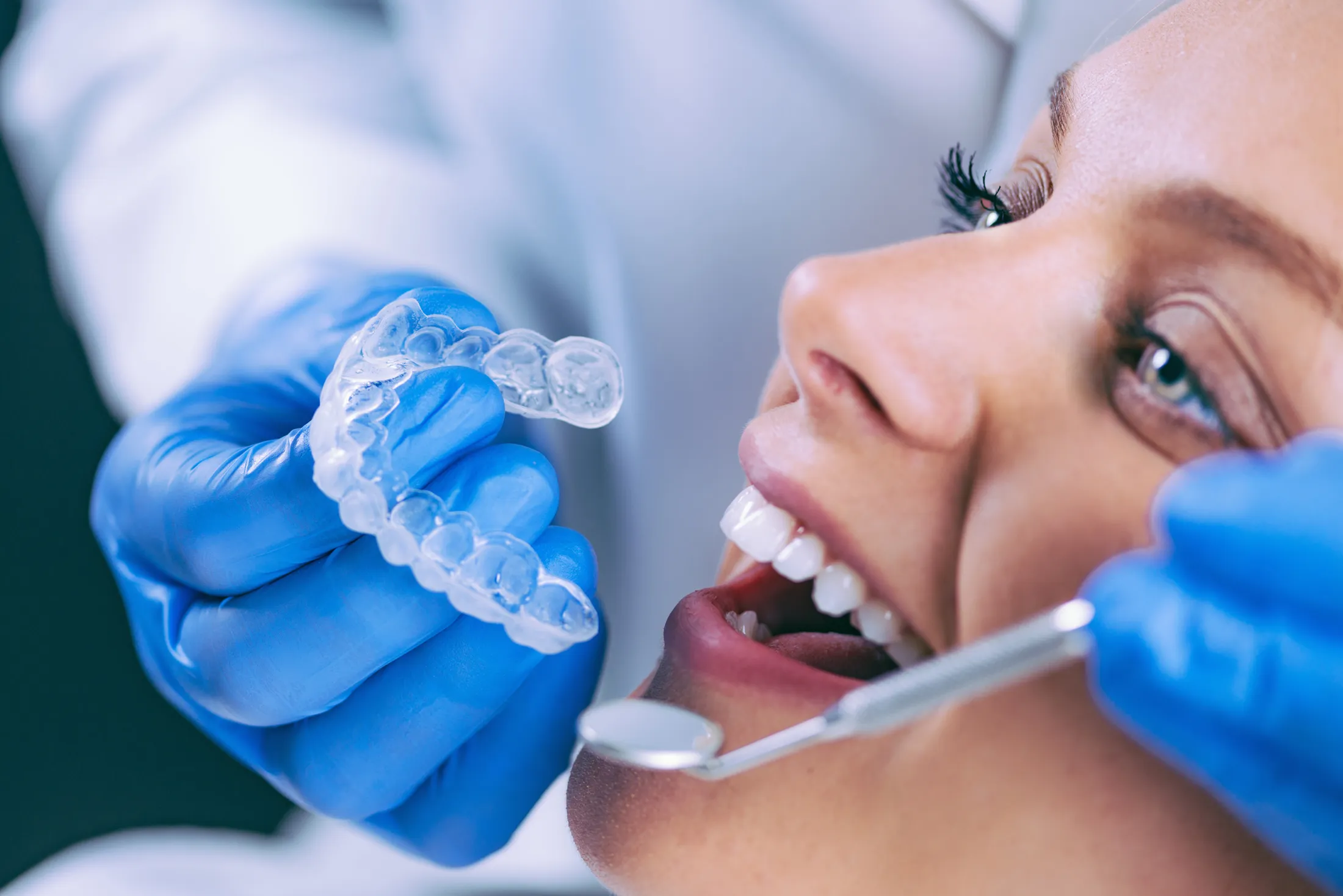 25759 at home teeth whitening kit