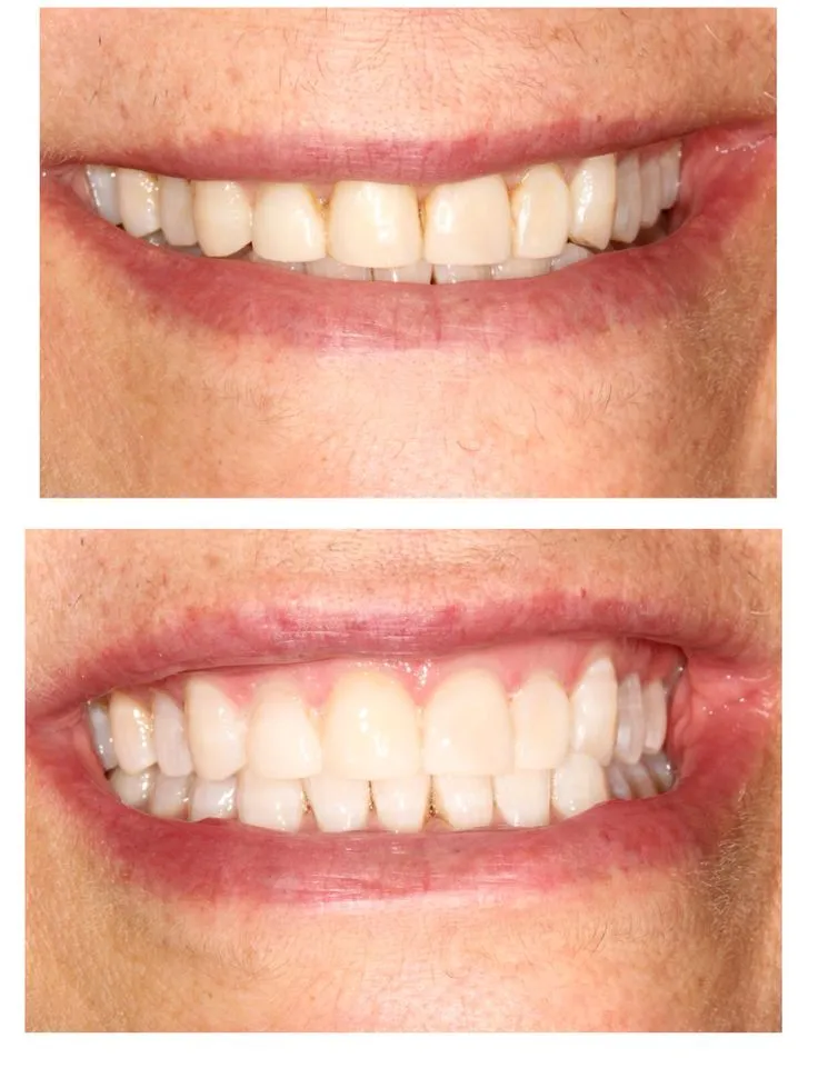 25767 teeth sensitivity management