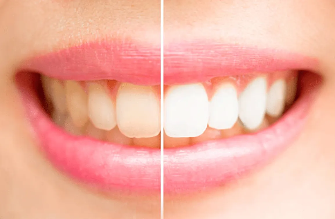 /img/25770-healthy-teeth.webp