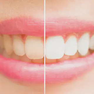 /img/25770-healthy-teeth.webp