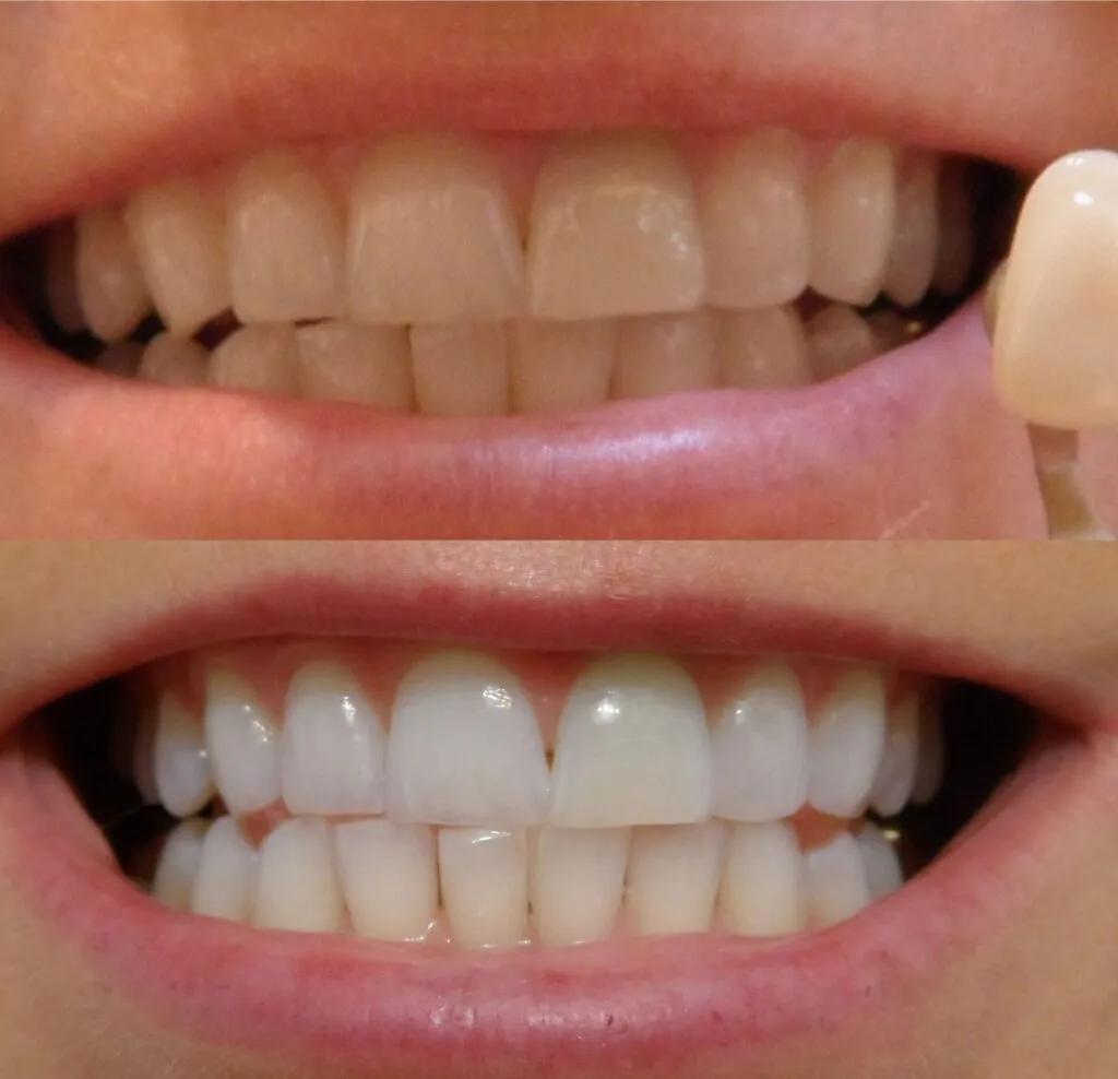 25773 healthy teeth diet
