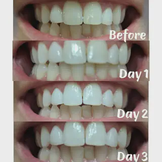 /img/25774-maintaining-white-smile.webp