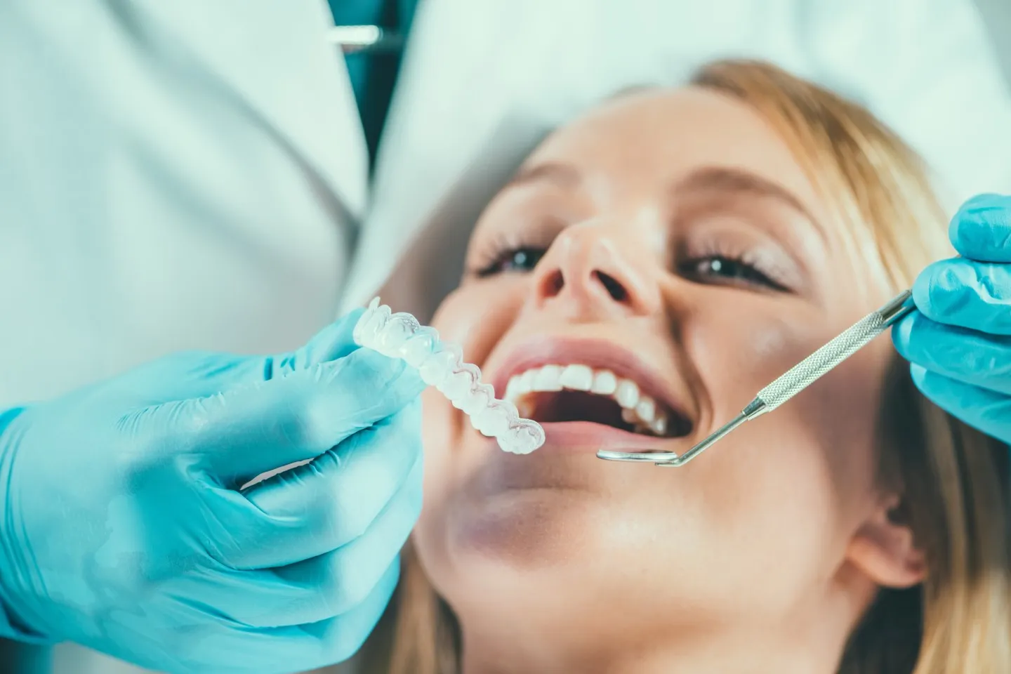25775 at home teeth whitening