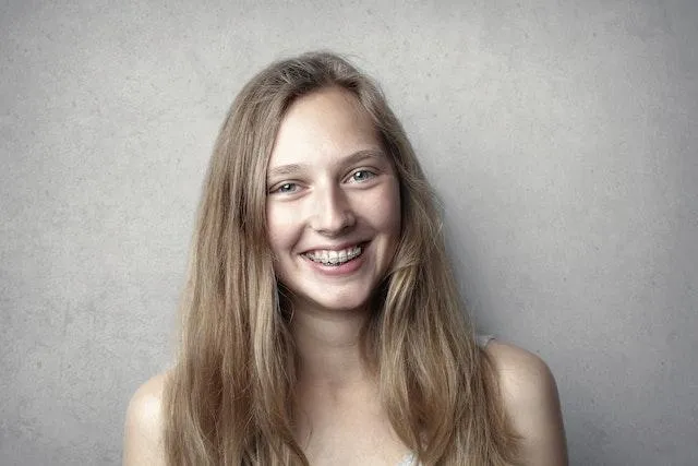 25785 teeth whitening after braces