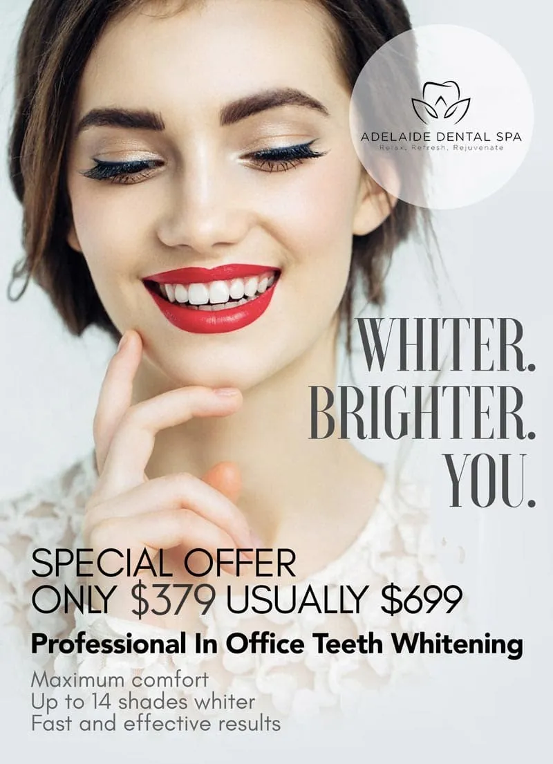 25787 in office teeth whitening