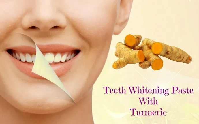 25788 teeth whitening alternatives