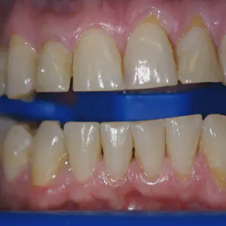/img/25790-zoom-whitening-consultation.webp