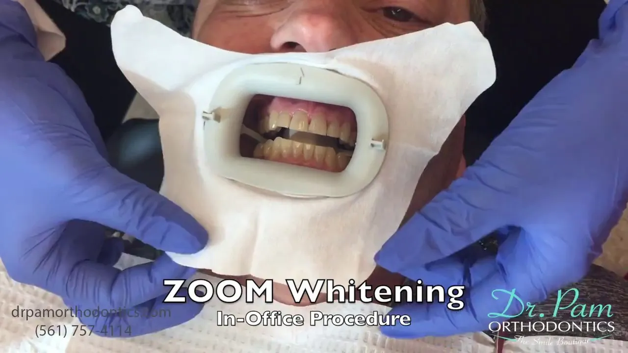 25790 zoom whitening gel
