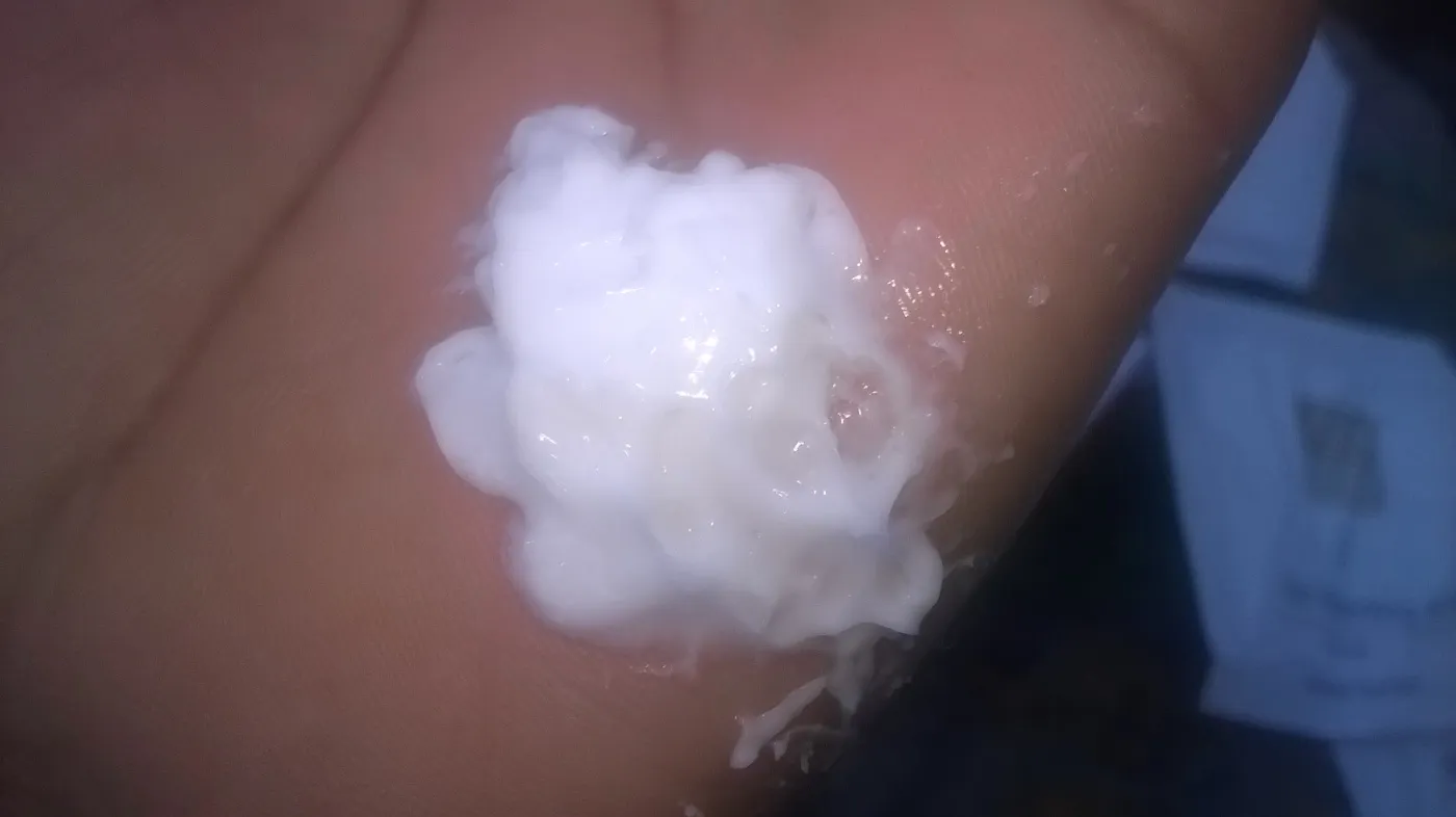 /img/25791-asta-berry-skin-results.webp
