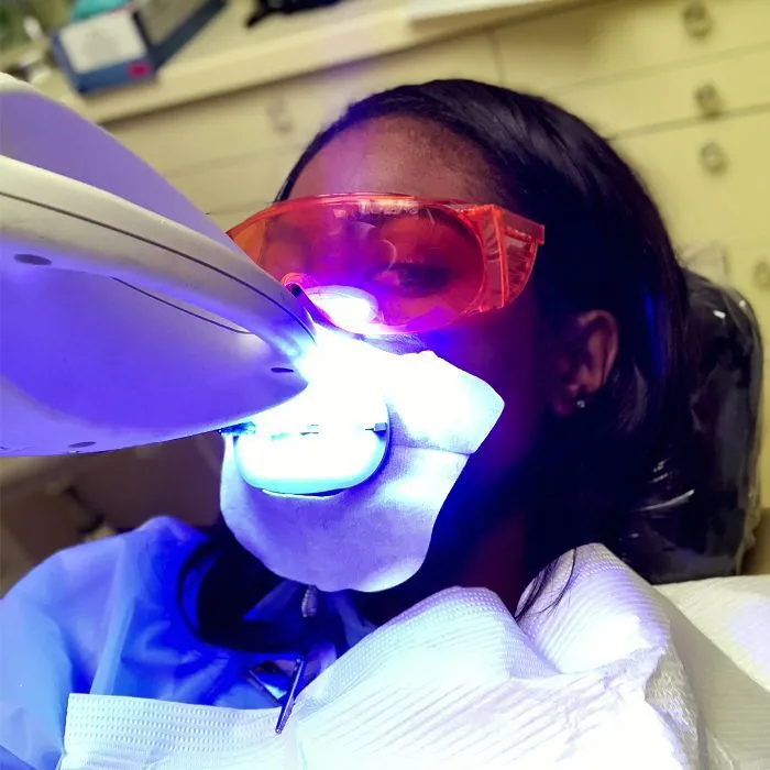 25792 laser teeth whitening mn results